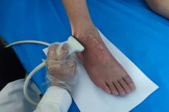 吃了药还是发作痛风？当心犯这四个治疗误区