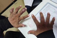 十个能让痛风发作的诱因，你能避免几个？