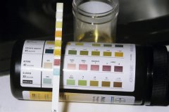 碱性食物如何区分？痛风患者多吃碱性食物有什么好处？